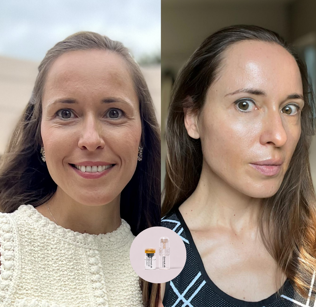 Peptiden vs. PDRN: 8 dingen die je wil weten voor je meegaat in de hype