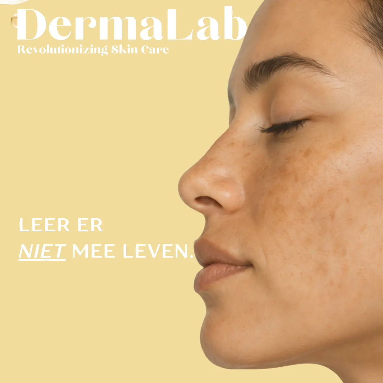 "Ik heb 14 jaar naar deze melasma-gids gezocht en niet gevonden. Dus schreef ik hem zelf."