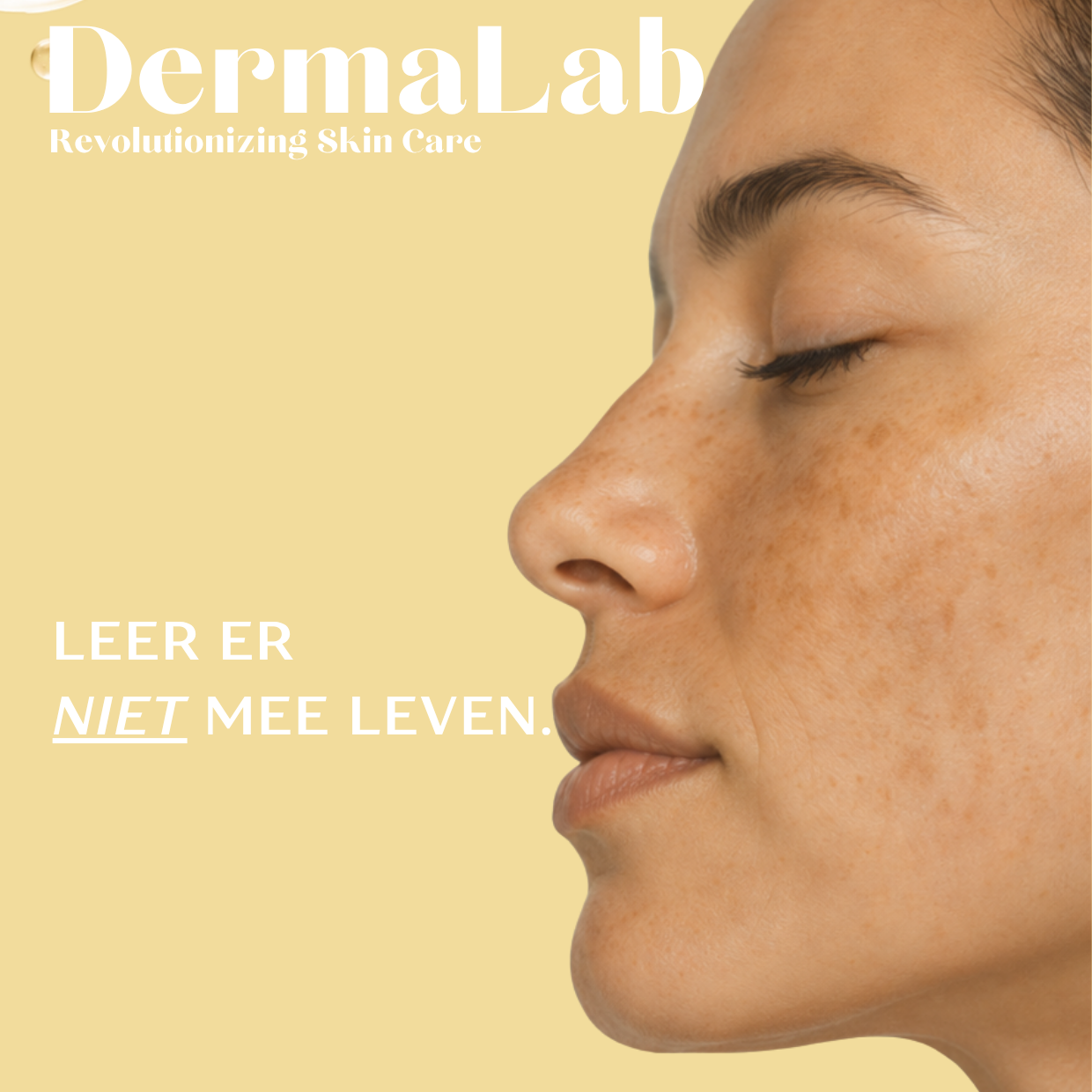 "Ik heb 14 jaar naar deze melasma-gids gezocht en niet gevonden. Dus schreef ik hem zelf."