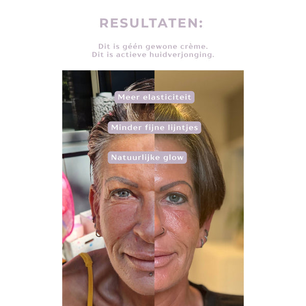 ANTI-AGING Micro Infusion Treatment 1 single application