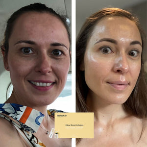Glow & Bright Infusion - 2 behandelingen, 2 weken plan