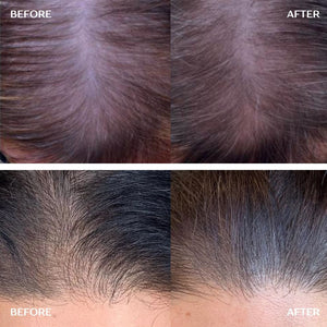 Hair Growth Infusion