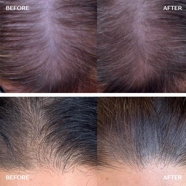 Hair Growth Infusion