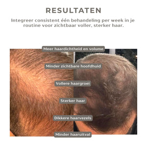 Hair Growth Infusion
