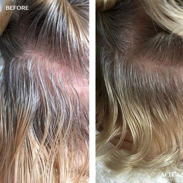 Hair Growth Infusion