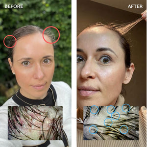 Hair Growth Infusion