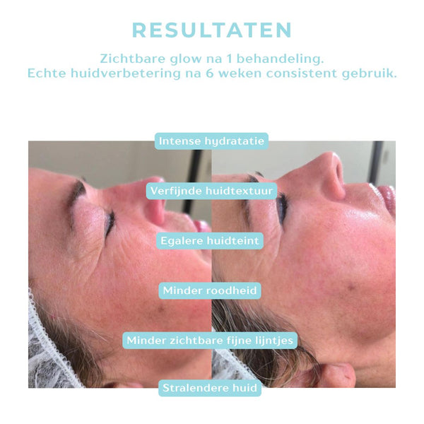 Hydrating Infusion 3-month plan