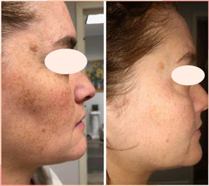 Cell Core Pro LED Mask - PRE ORDER