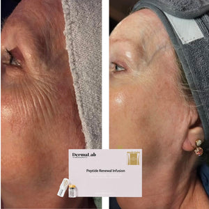 Peptide Renewal Infusion