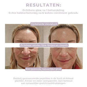 Peptide Renewal Infusion
