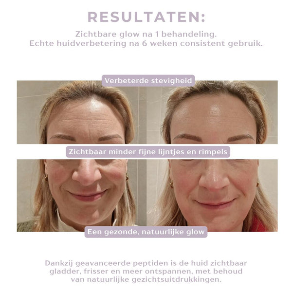 Peptide Renewal Infusion