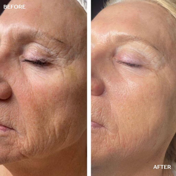Peptide Renewal Infusion