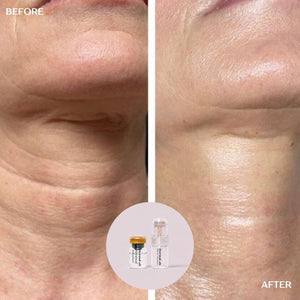 Peptide Renewal Infusion