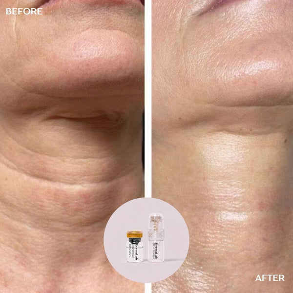 Peptide Renewal Infusion