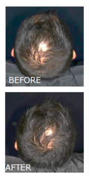 Hair Growth Infusion