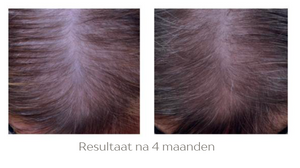 Hair Growth Infusion