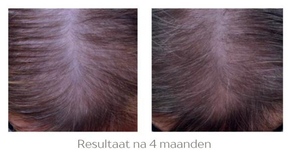 Hair Growth Infusion