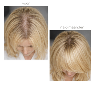 Hair Growth Infusion