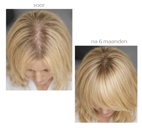 Hair Growth Infusion