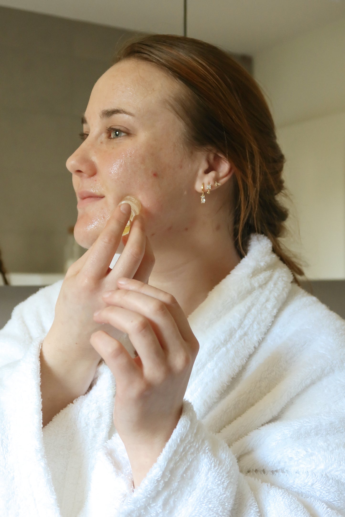 Acne Micro Infusion